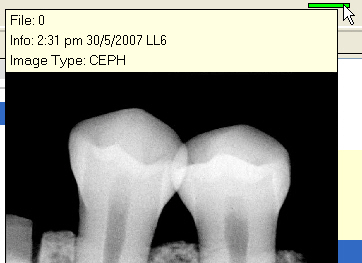 Tool tip for tooth image