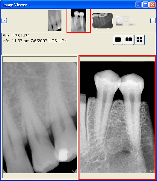 Image viewer - two image example