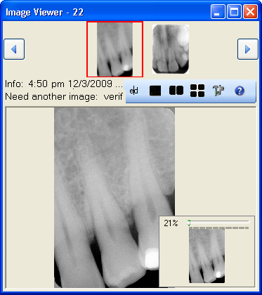 Image View example 1