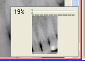 Image Viewer slider control