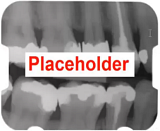 PlaceHolder-Xrays