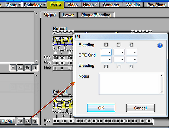 PerioTab-BPE-blank