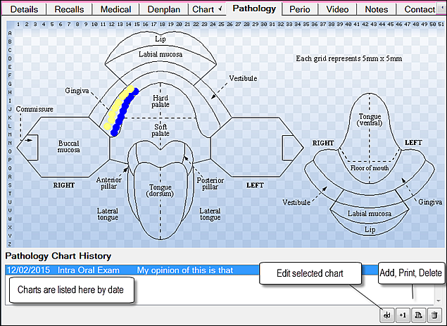 FinalChart