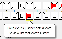 Open1ToothHistory