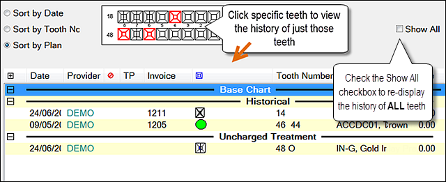 SHowSpecificTeeth