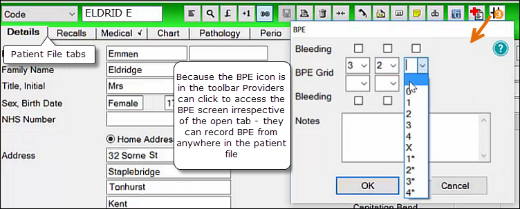 BPE-buttonlocation