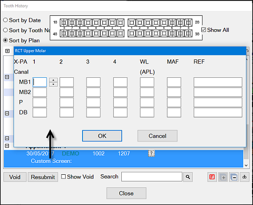 Double-click Custom Screen