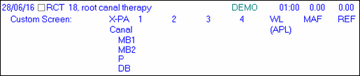 Example-CustomScreenA